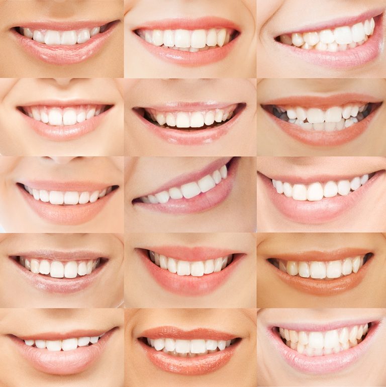 Diseño Digital De La Sonrisa Clínica Dental García Vega